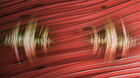 muscle resonance frequency