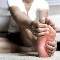 neuropathy